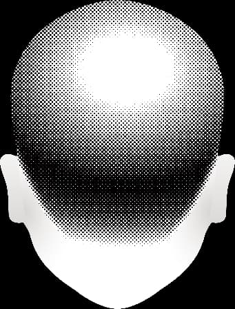 後腦勺