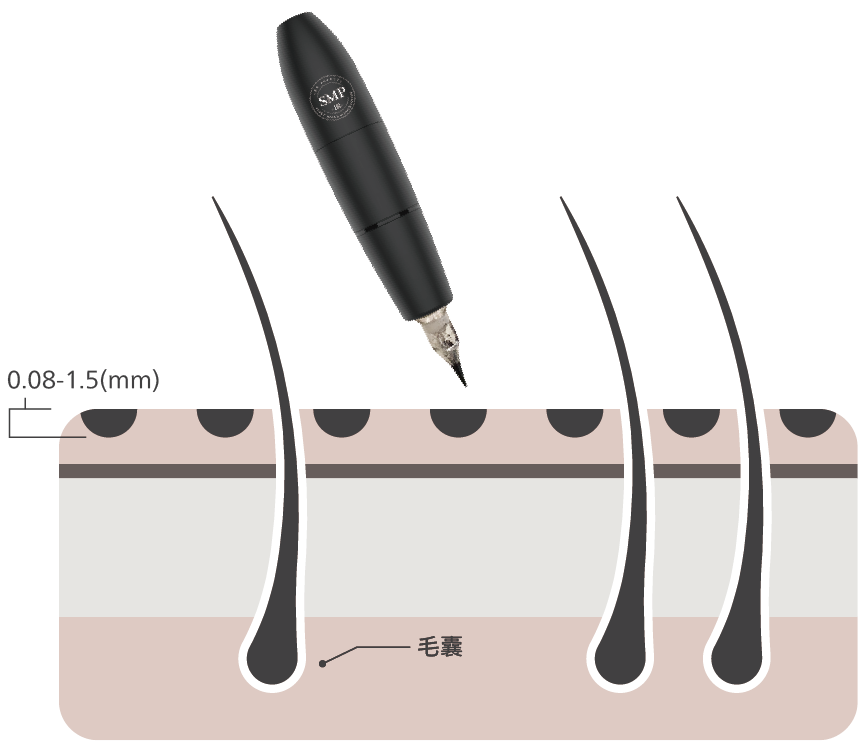 5D紋髮獨有技術沒有傷口一步到位並且可以完整的保護毛囊