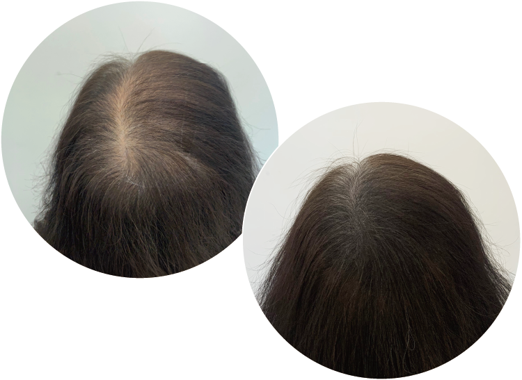 HR SMP 紋髮技術實績